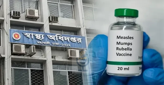 হাম ও উপসর্গ নিয়ে আরও ৯ শিশুর মৃত্যু