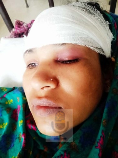 পাইকগাছায় জমি বিরোধে রক্তক্ষয়ী সংঘর্ষ, নারী আহত।।